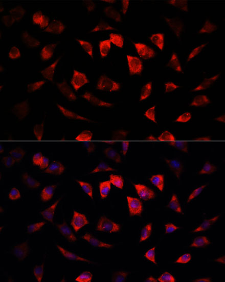 IGFBP4 antibody