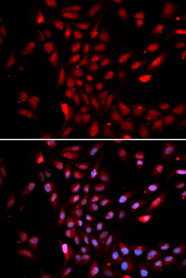 KPNA4 Antibody