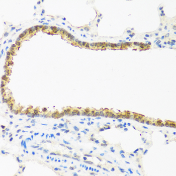 CDKN2C antibody