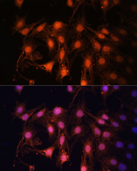 E2F1 antibody