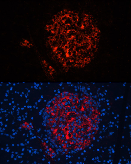 INS antibody