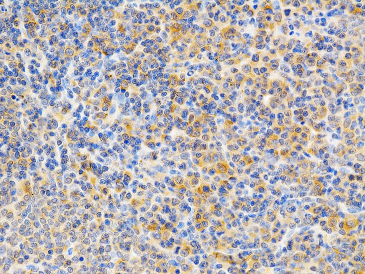 PRKCE Antibody