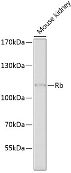 RB1 antibody