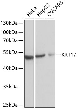 KRT17 Antibody