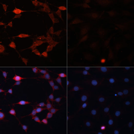 RPS6KB1 Antibody