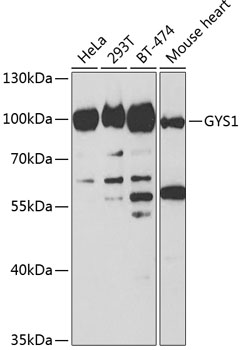 GYS1 antibody