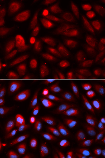 ACP5 Antibody