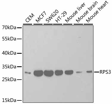 RPS3 Antibody