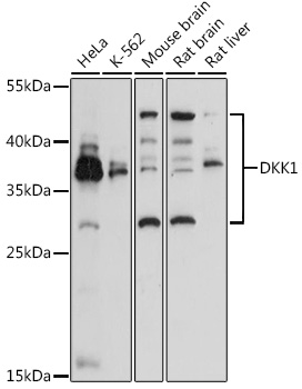 DKK1 antibody