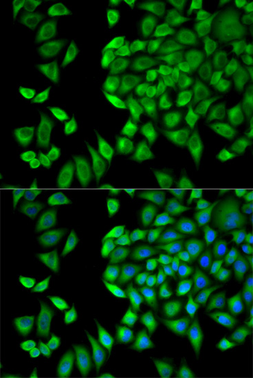 WNK1 Antibody