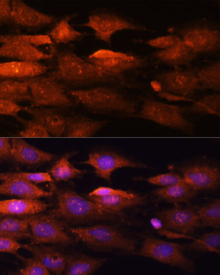 WASL Antibody