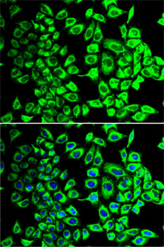 SDHA Antibody