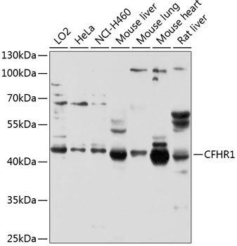 CFHR1 antibody