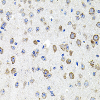 CDH23 antibody