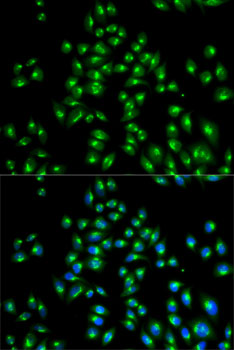 USO1 antibody