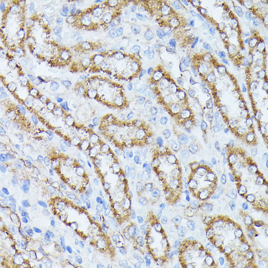 PPP2CB antibody