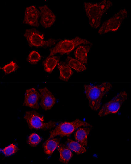 CSF2RA antibody