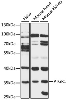 PTGR1 Rabbit Polyclonal Antibody