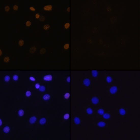 Acetyl-Histone H4-K16 pAb