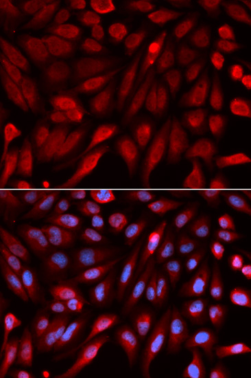 SDCBP Antibody