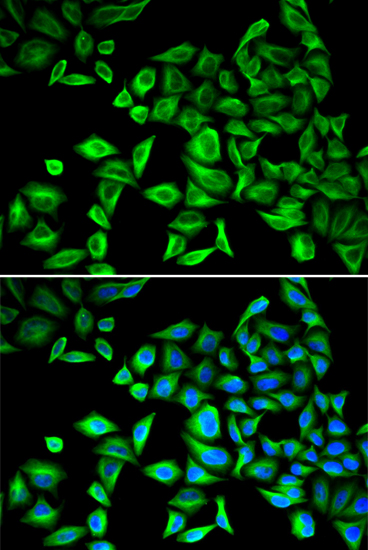 CRP Antibody