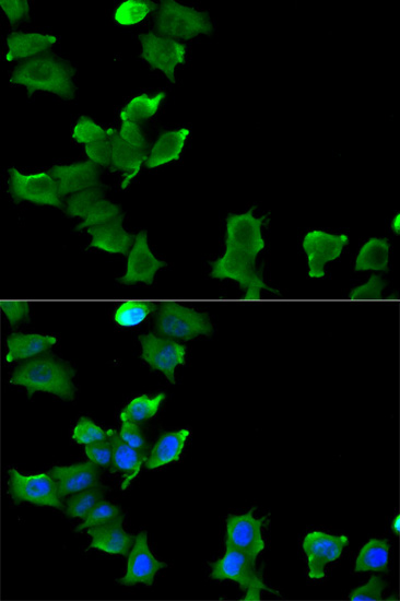 GLUL Antibody