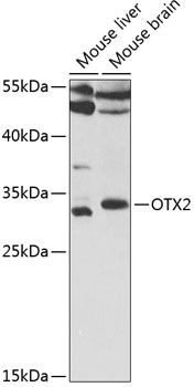 OTX2 Antibody