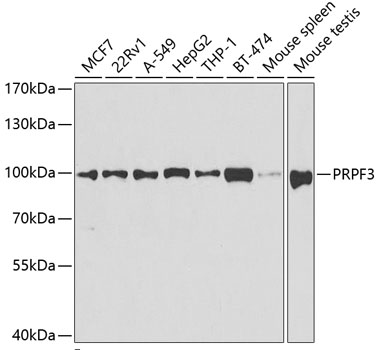 PRPF3 Antibody