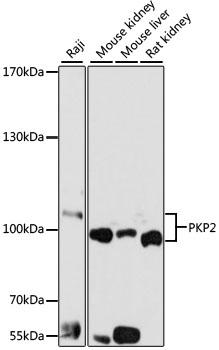 PKP2 Antibody