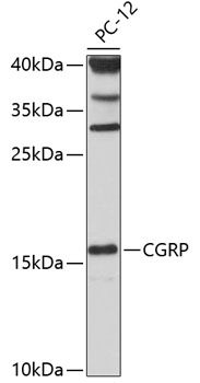 CALCA Antibody