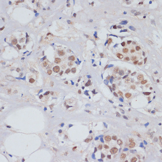 MTR4 antibody