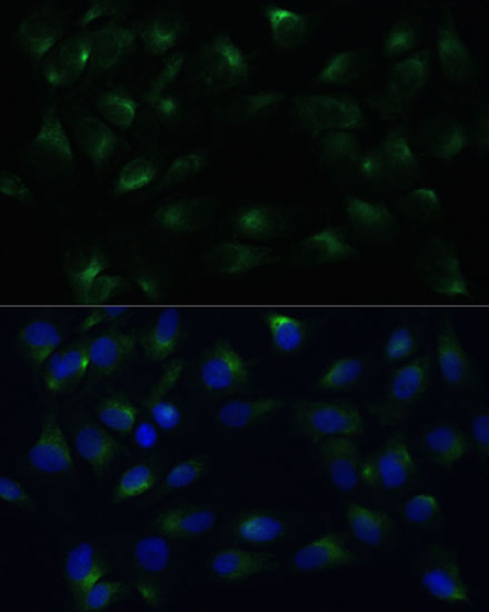 PGRMC1 Antibody