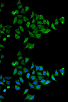 DOK1 Antibody