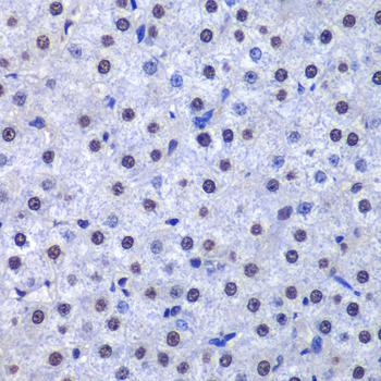 GSTP1 Antibody