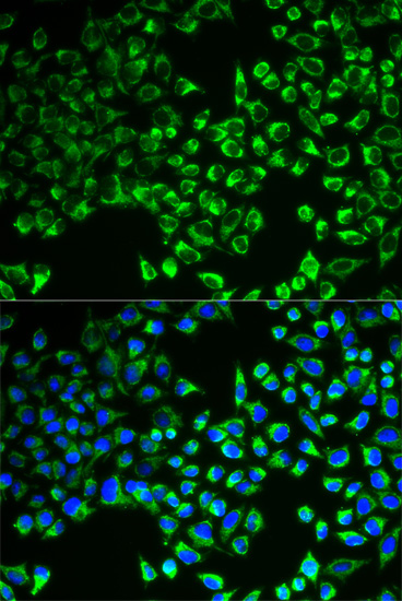 CS Antibody