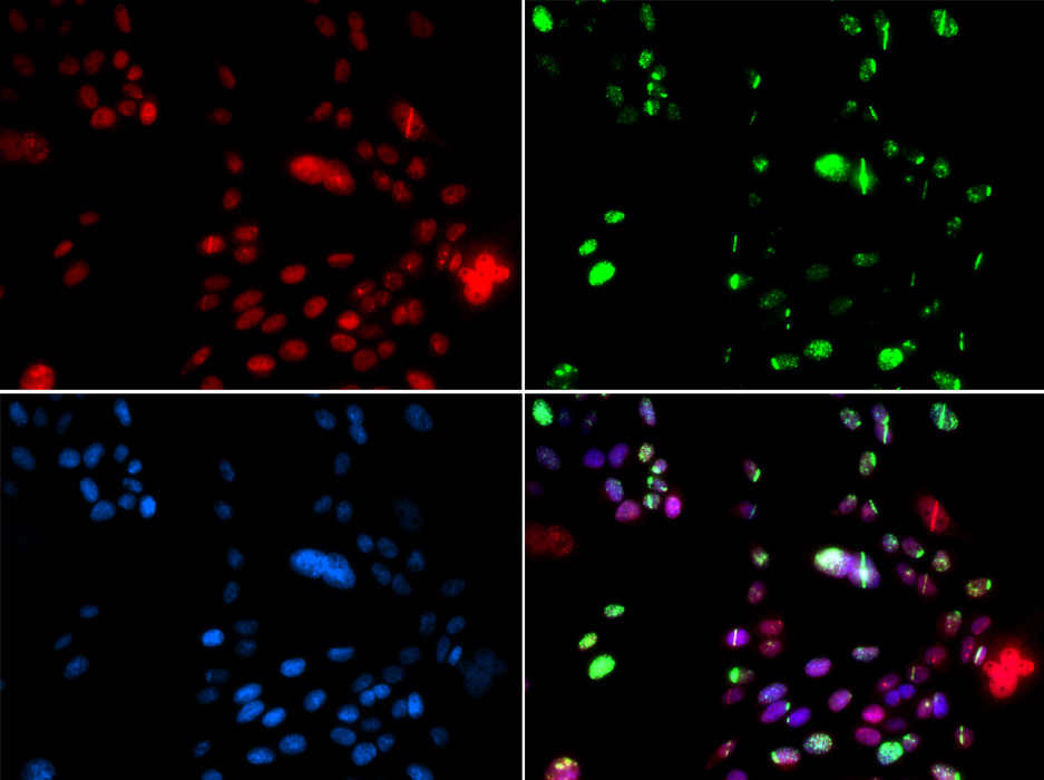 PIAS1 antibody