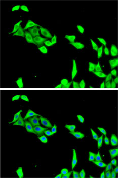 CDK5 Antibody