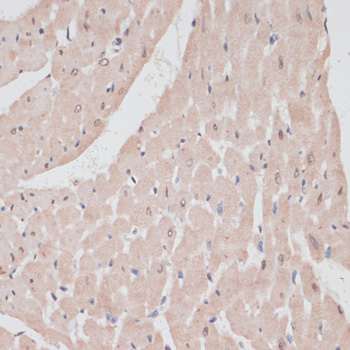 PRPF31 Antibody