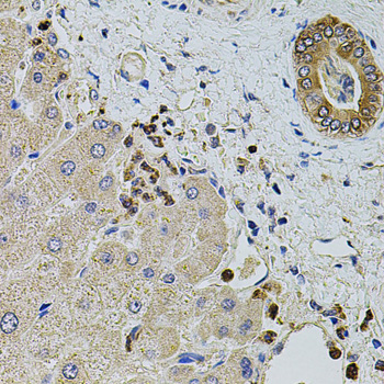 KTN1 antibody