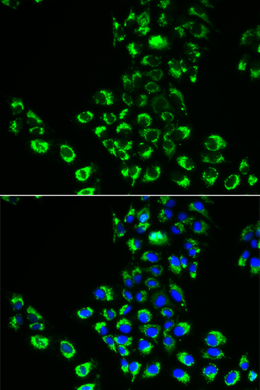 EIF5B antibody