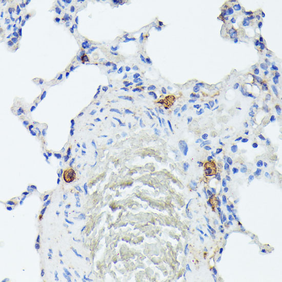 TIAL1 Rabbit Polyclonal Antibody