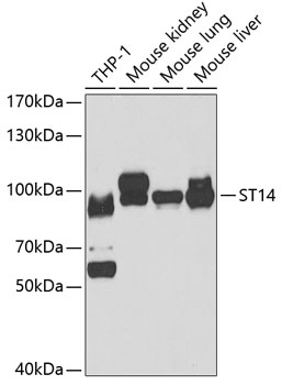 ST14 antibody