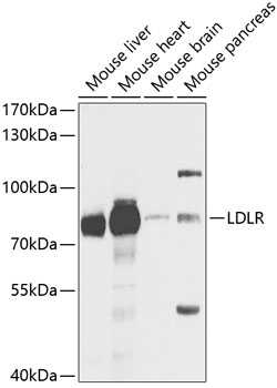 IL31RA antibody