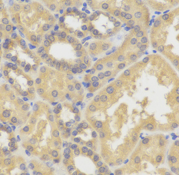 SMYD5 antibody