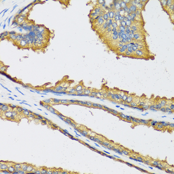 CXCL11 antibody