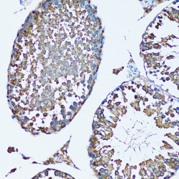 FDFT1 antibody