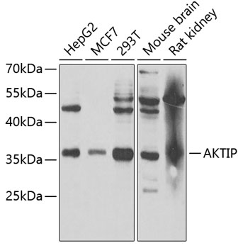 AKTIP antibody