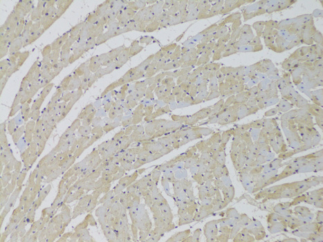 SCARB2 antibody