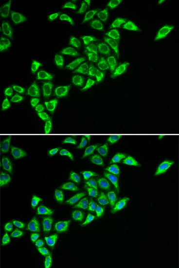 DLAT antibody