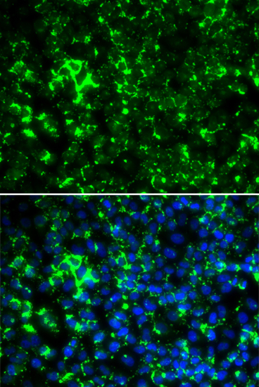 KCNA2 antibody